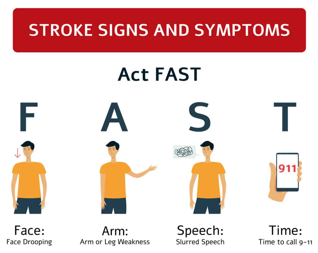 FAST Recognizing Stroke